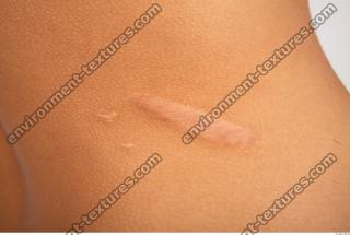 human skin scars 0006